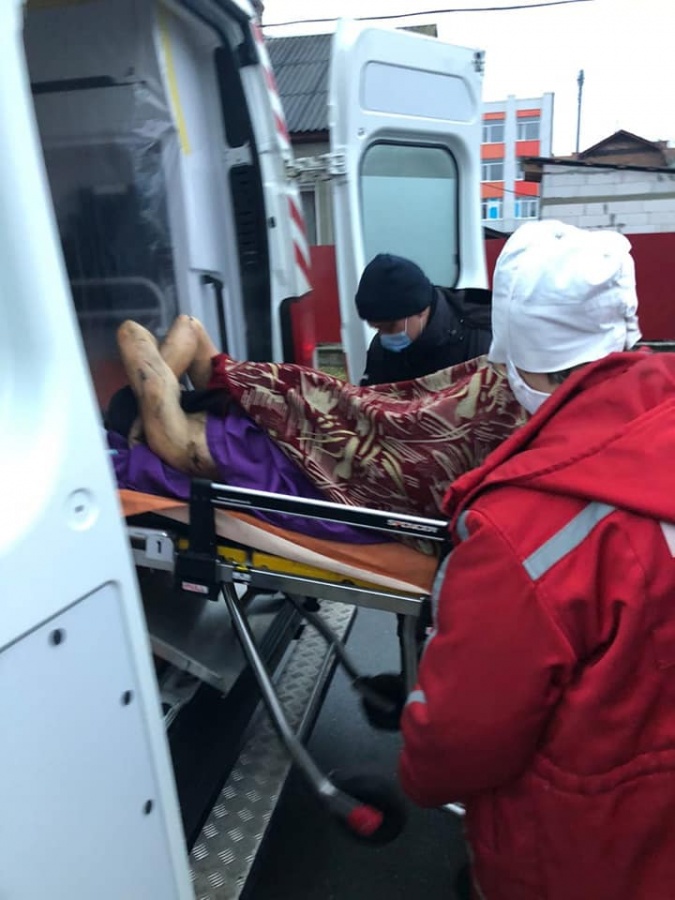 У Костополі чоловік навмисно підпалив себе і своє помешкання