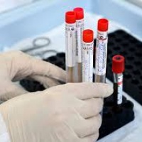 В Україні готуються запустити тестування на антитіла до COVID-19